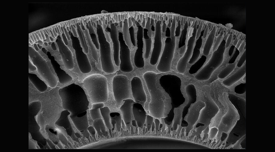 醋酯纤维：高端技术纺织品领域的明日之星!
